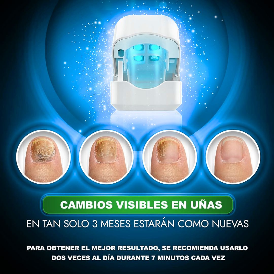 Laser Para Tratamiento De Uñas comprexia™