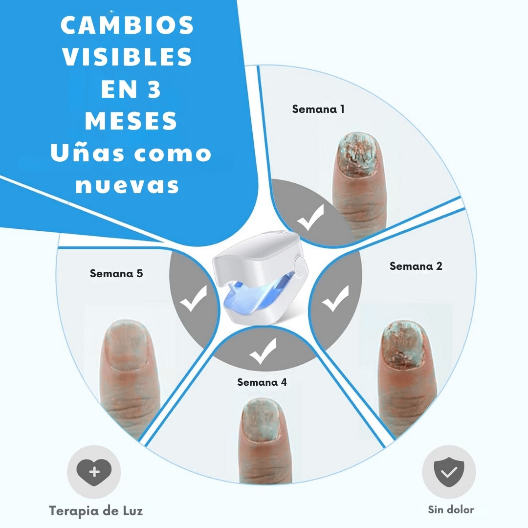 Laser Para Tratamiento De Uñas comprexia™