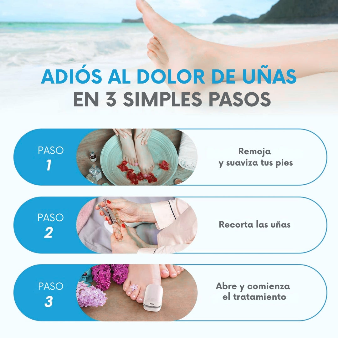 Laser Para Tratamiento De Uñas comprexia™