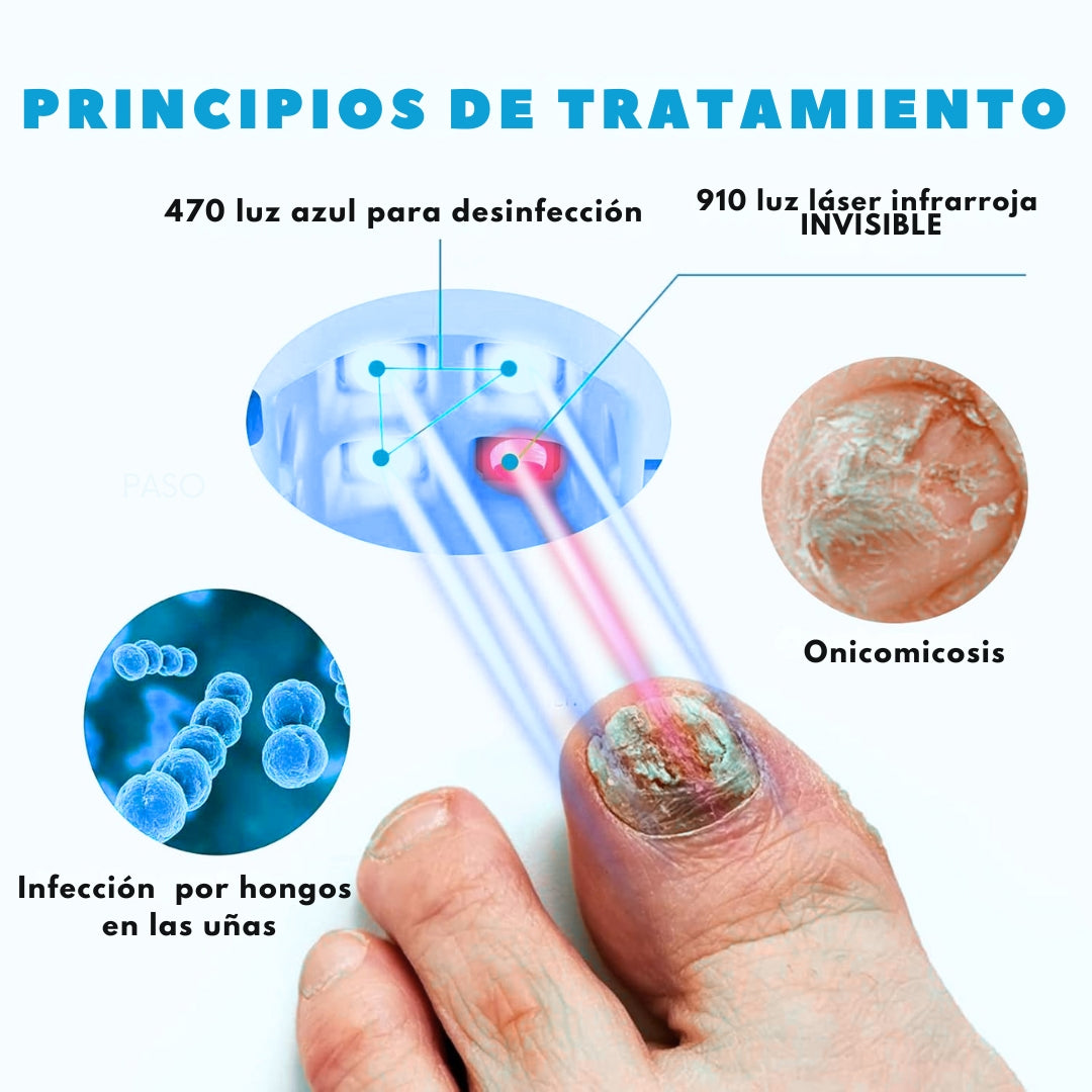 Laser Para Tratamiento De Uñas comprexia™