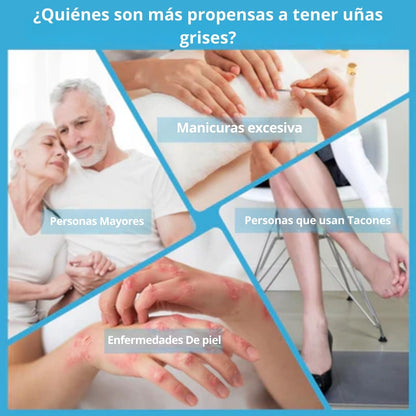 Laser Para Tratamiento De Uñas comprexia™